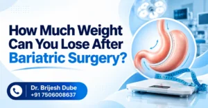 bariatric surgery weight loss guide